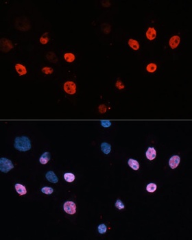 CBX5 Antibody