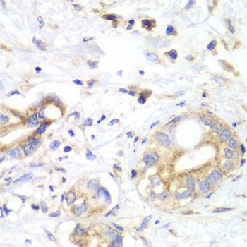 TXN2 Antibody