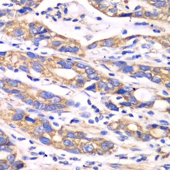 TXN2 Antibody