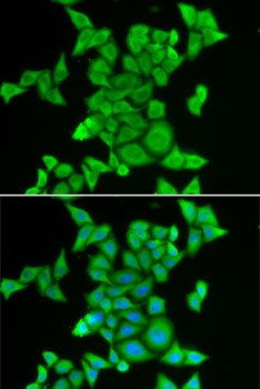 STRN3 Antibody