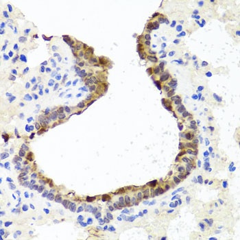 TOPBP1 Antibody