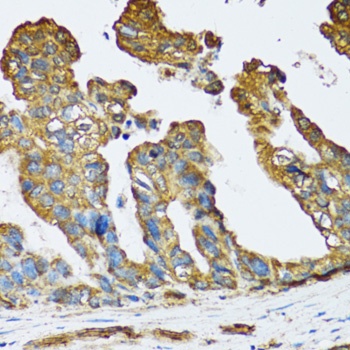 SLC25A13 Antibody