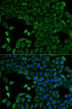 SLC25A13 Antibody