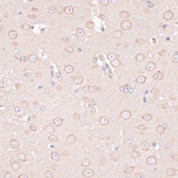ABCF2 Antibody