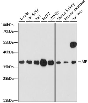 AIP Antibody