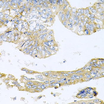 HDAC3 Antibody