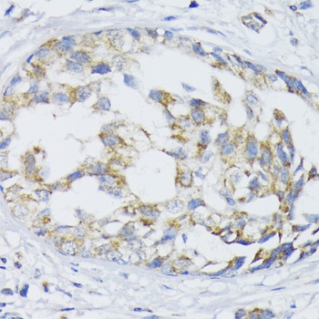 SLC30A1 Antibody