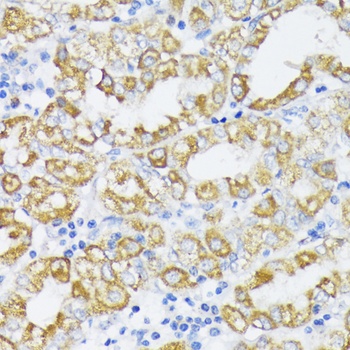 SLC30A1 Antibody