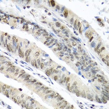 TIA1 Antibody