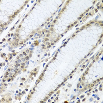 TIA1 Antibody