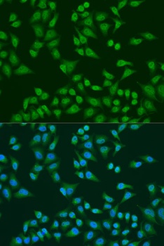TIA1 Antibody