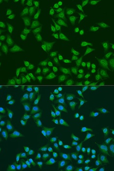 TIA1 Antibody