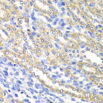 SURF1 Antibody