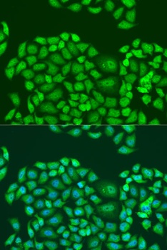 SMN2 Antibody