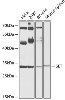 SET Antibody