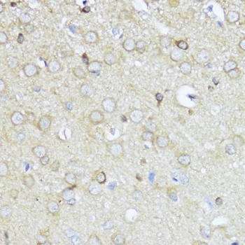 Akt2 Antibody