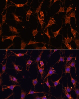Akt2 Antibody