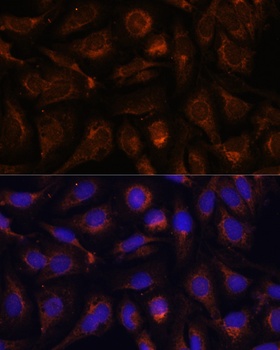 Akt2 Antibody