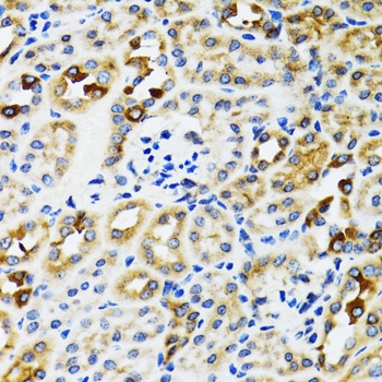 RPN1 Antibody