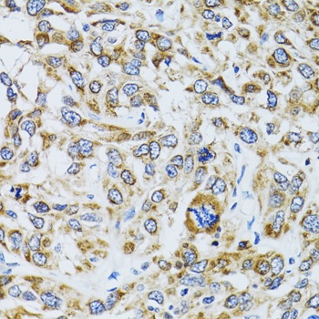 RPN1 Antibody