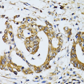 RPN1 Antibody