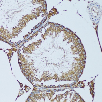 RPN1 Antibody