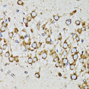 RPN1 Antibody