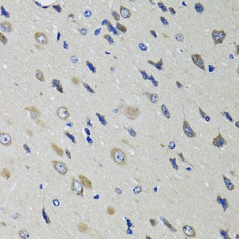 RBP4 Antibody