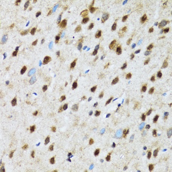 PSMD13 Antibody