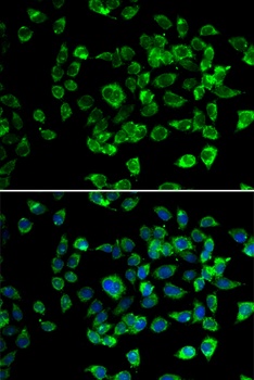 PSMD13 Antibody