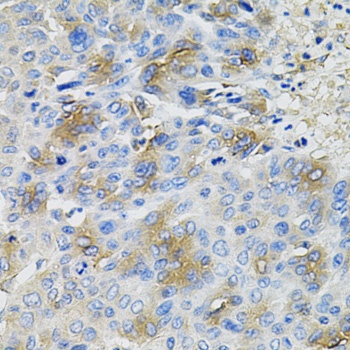 SERPINA1 Antibody