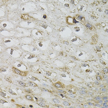 SERPINA1 Antibody