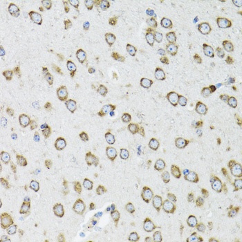 OGDH Antibody