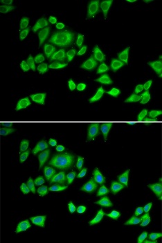 OGDH Antibody