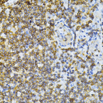 MT-ND5 Antibody