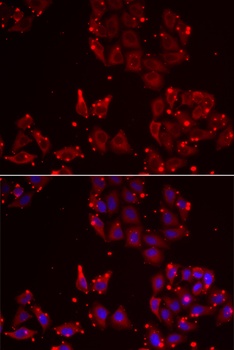 MSRA Antibody