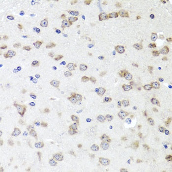 IGFBP5 Antibody