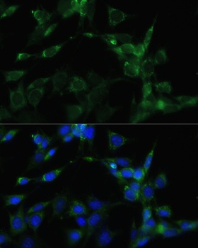 HSP90AA1 Antibody