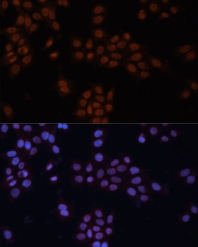 GTF2I Antibody