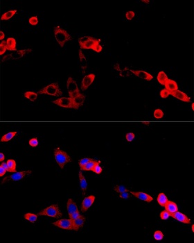 FGFR2 Antibody