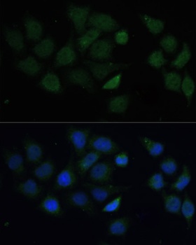 CPT2 Antibody