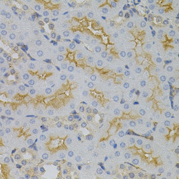 CDKN2C Antibody