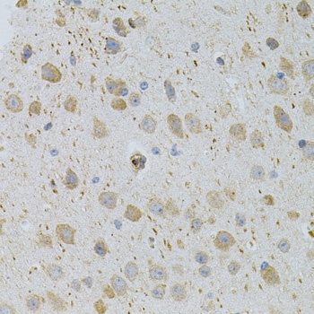 CDKN2C Antibody