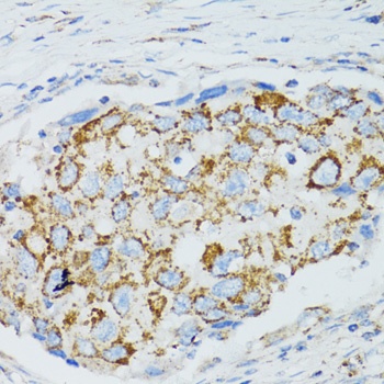 C1 Inactivator Antibody