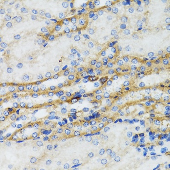C1 Inactivator Antibody