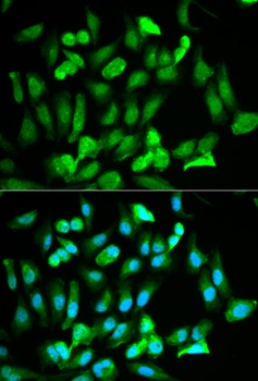 ERG Antibody