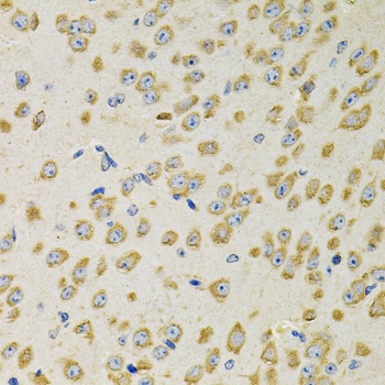 ADSS Antibody