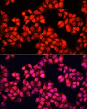 ALAD Antibody