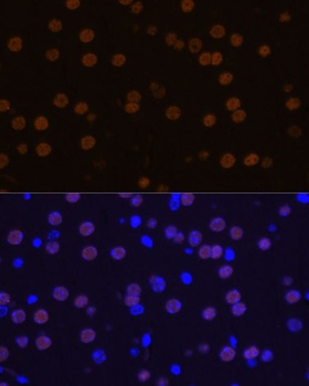 MEF2C Antibody
