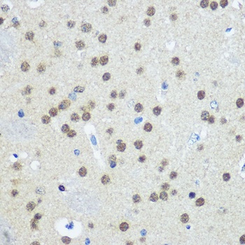 UBA1 Antibody